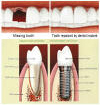 implant_small implant_small