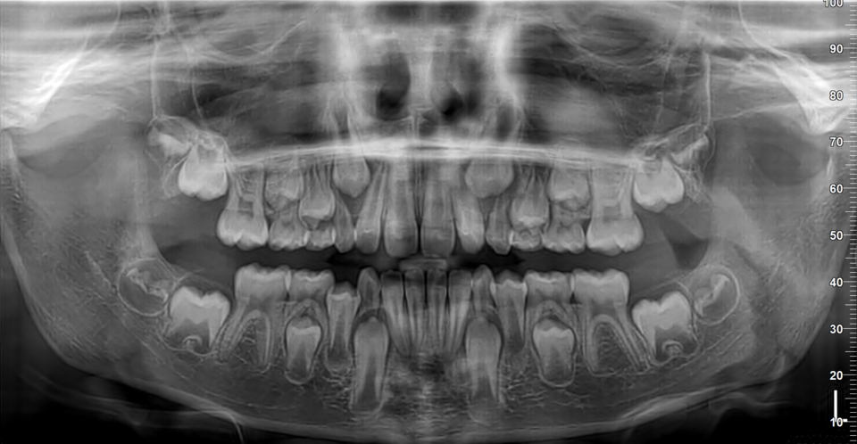 afd-xray afd-xray